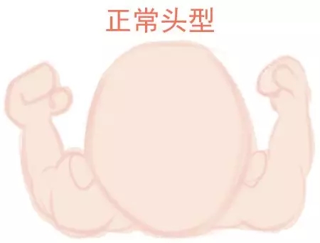 ԲͷվɱͷЩ趼֪1.webp.jpg