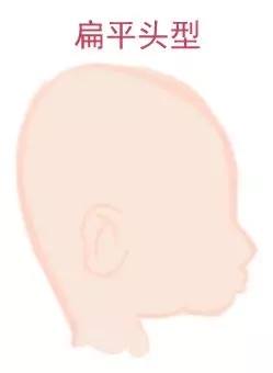 ԲͷվɱͷЩ趼֪4.webp.jpg