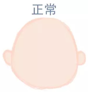 ԲͷվɱͷЩ趼֪5.webp.jpg